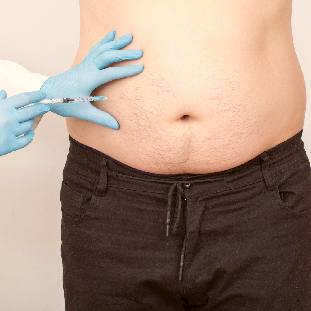 Online: Fat Dissolving injections