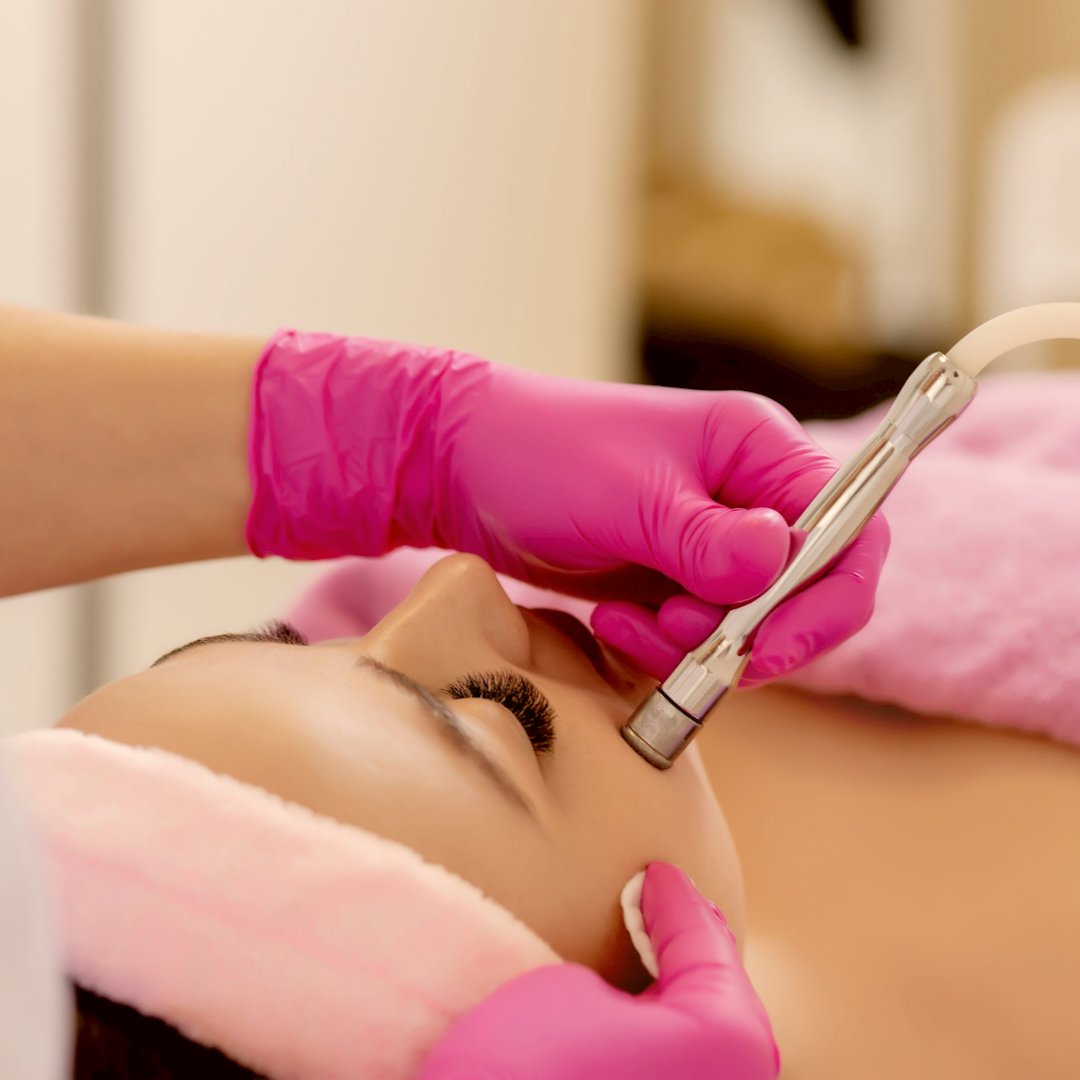 Microdermabrasion